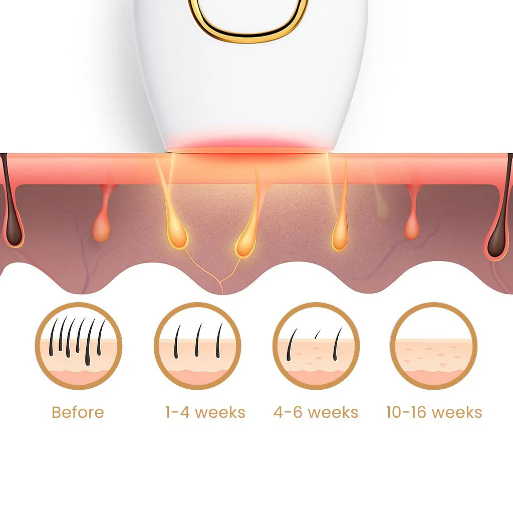 IPL Hair Remover- No More Unpleasent Visits To Saloon